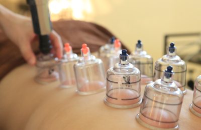 背面カッピングイメージ画像