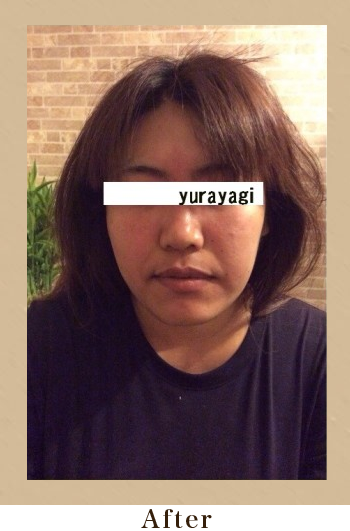 美筋小顔セラピーAfter画像03