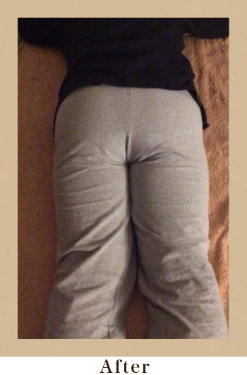 フーレセラピーAfter画像01