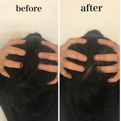 小顔マジックAfter画像04