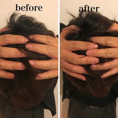 小顔マジックAfter画像06