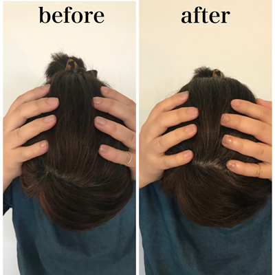 小顔マジックAfter画像08